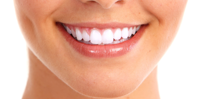 Dentistria Estética na PERFECT SMILE